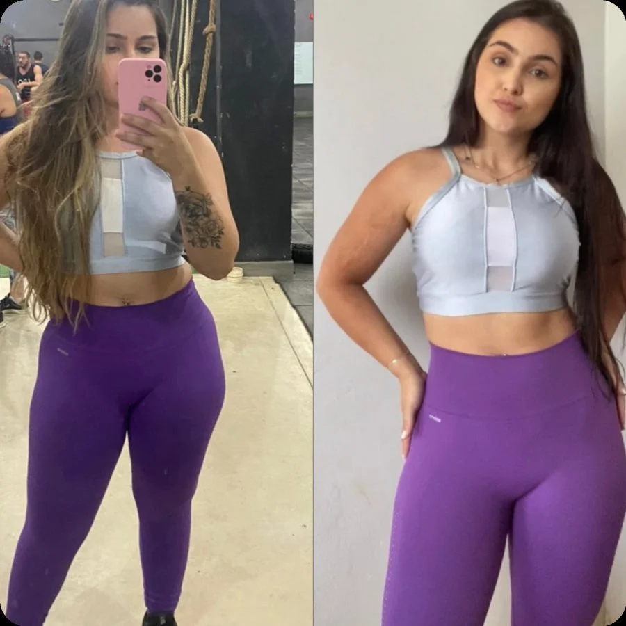 Antes e depois Daniela